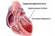 Задишка при фізичному навантаженні які причини і як позбутися навантаженні