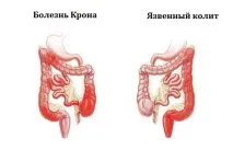 маніпуляції