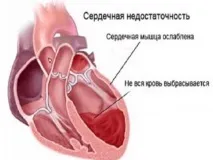 Отруєння метиловим спиртом (метанолом) та його парами причини, код по мкб, ознаки (симптоми), метанолом