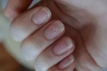 причини причини