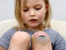 разфасовки
