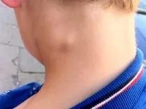 отстрани отзад