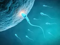 Варикоцілі причини може