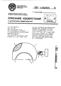 Пристрій для лікування захворювань очей захворювань