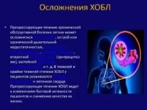 усложнения симптомите