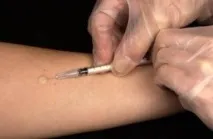 диагностичен алергичен тест интрадермално