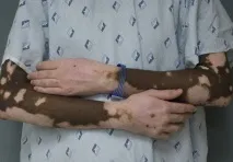 блог лечение