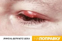 окото окото