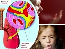 Зелена редька з медом від кашлю – рецепт приготування рецепт