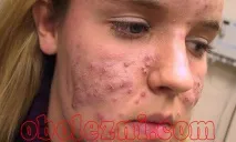 лицето снимка