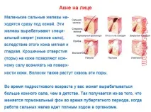 акне новородени
