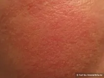 ефект стареене