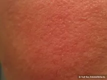 лифтинг ефект