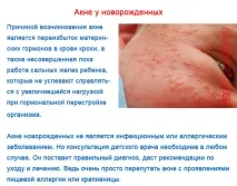 акне акне