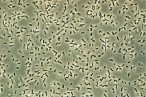 Bacillus subtilis (сінна паличка) bacillus