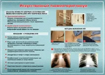 Колапсотерапія штучного
