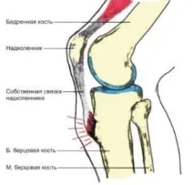 schlatter причини
