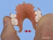 материал breflex