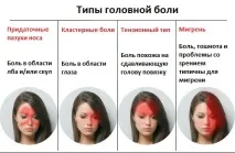 Що таке мігрень симптоми та лікування, причини виникнення виникнення