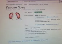 Донорство Нирки - За і Проти (Ціна, Наслідки) нирки