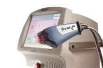 Фракційний лазер Fraxel - Fraxel ВИДАЛЕННЯ РОЗТЯЖОК фракційний
