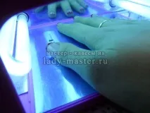 френски лъкове