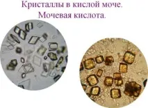 киселина тялото