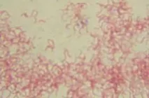 pneumoniae pneumonia