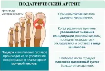 компреси компреси