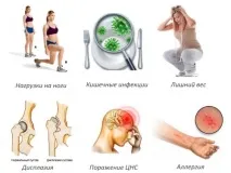 артрит компреси
