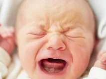 Коротка вуздечка язика у дитини як визначити, навіщо потрібна пластика, чи болячепідрізати коротка