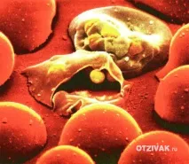 малария малария
