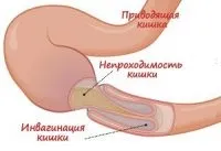 чревна новородени