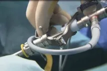 Операція на простату - хірургічне лікування простатиту, хірургічні методи лікування аденоми та хірургічне