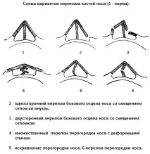 снимки носа
