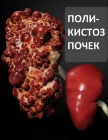 лечение дроб