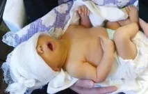 Підвищений рівень білірубіну при загальному аналізі сечі рівень