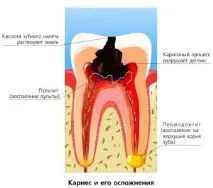притискането лечение