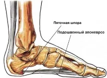 П’яткова шпора фото та ціна, ЗНИЖКИ АКЦІЇ шпора