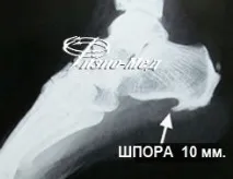 П’яткова шпора фото та ціна, ЗНИЖКИ АКЦІЇ ціна