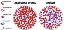 гострим