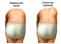 причини причини