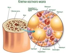 лейкозом