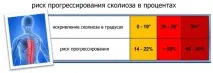 Сколіоз 4 ступеня - симптоми та лікування ступеня