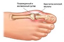 пръстите пръстите