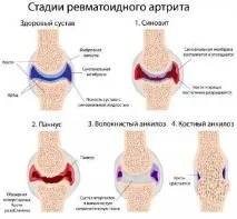 заболявания заболявания
