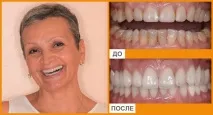 стоматология анестезия седация