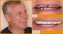 анестезия седация анестезия седация