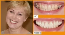 кишинев стоматология