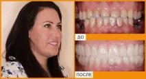 стоматология анестезия седация